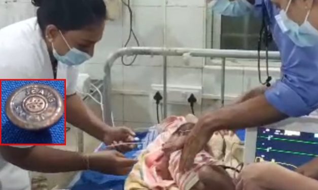 ಹಸುಳೆಯ ಗಂಟಲಿಗಿಳಿದ ಪ್ಯಾಂಟ್ ಬಟನ್! ಜೀವ ಉಳಿಸಿದ ಸರಕಾರಿ ಆಸ್ಪತ್ರೆ ವೈದ್ಯರು