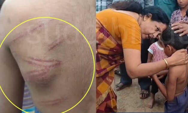 Teacher/ಪಾಠ ಕಲಿಯಲಿಲ್ಲ ಎಂಬ ಕಾರಣಕ್ಕೆ ವಿದ್ಯಾರ್ಥಿಗೆ ಥಳಿತ : ಬಾಸುಂಡೆ ಮೂಡಿಸಿದ ಶಿಕ್ಷಕಿ