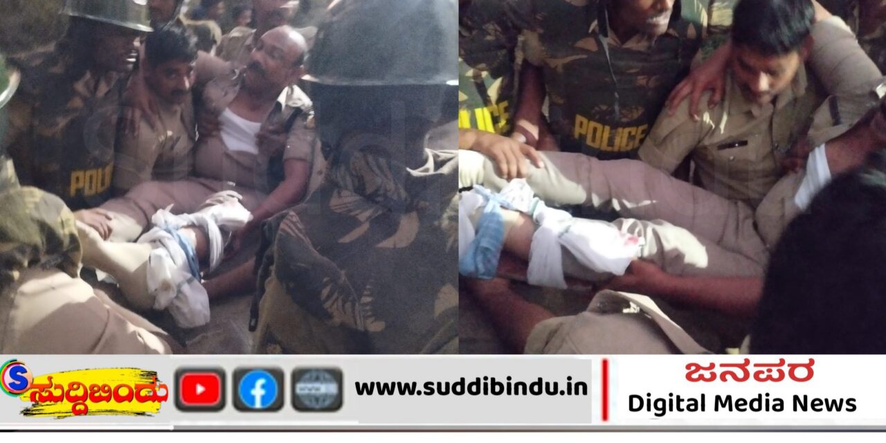 ಬೆಂಕಿ ಅವಘಡ : ಎ.ಎಸ್.ಪಿ ಮಹಾಂತೇಶ್ವರ ಜಿದ್ದಿ   ಗಂಭೀರ