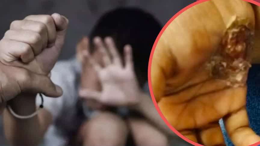 ಮಗನಿಗೆ ಬಾತ್‌ರೂಮ್‌ನಲ್ಲಿ ಕೂಡಿ ಹಾಕಿ ತಂದೆಯಿಂದ ಚಿತ್ರಹಿಂಸೆ : ಹೆಗಡೆಯಲ್ಲಿ ಘಟನೆ